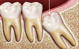 Top 5 Nha khoa nhổ răng khôn uy tín và chất lượng nhất tại Cần Thơ